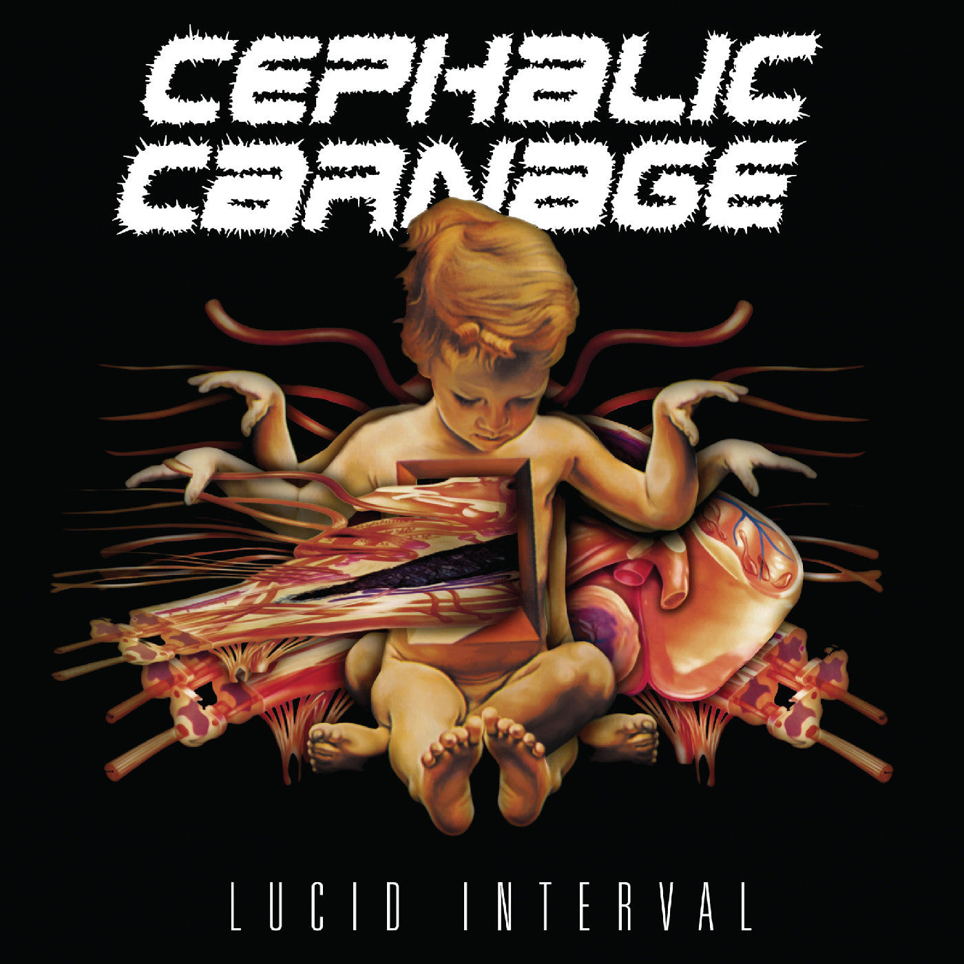 CEPHALIC CARNAGE - Lucid Interval LP (MARBLE)