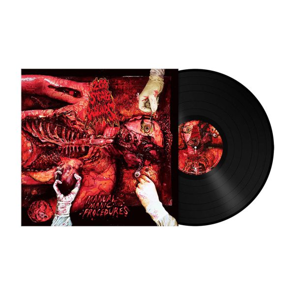 200 STAB WOUNDS - Manual Manic Procedures LP