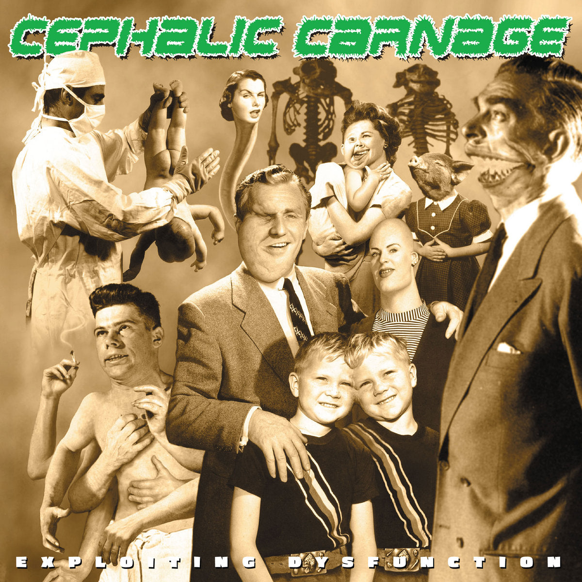 CEPHALIC CARNAGE - Exploiting Dysfunction (Deluxe 25th Anniversary Reissue) 2LP (PREORDER)
